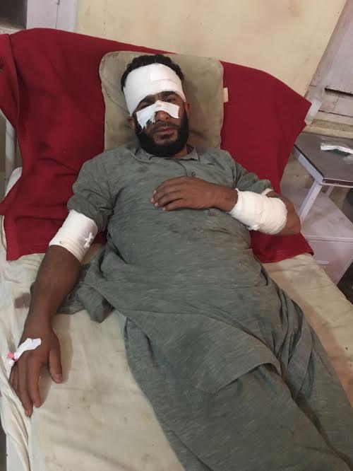 PDD need base labour injured during work